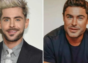 Zac Efron casi muere en accidente que deformó su cara