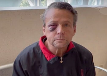 Alfredo Adame teme por su seguridad tras recibir golpiza: «Me siento intranquilo»