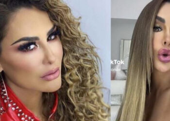 Ninel Conde impacta con su rostro cambiado: «Se le fue la mano»